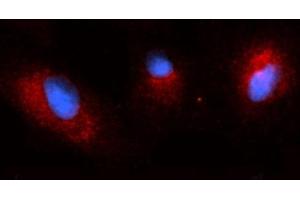 Immunofluorescence (IF) image for anti-Osteoactivin (GPNMB) (AA 22-474) antibody (PE) (ABIN5566465)