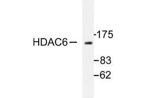 Image no. 1 for anti-Histone Deacetylase 6 (HDAC6) antibody (ABIN265458) (HDAC6 anticorps)