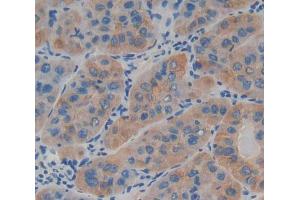 Used in DAB staining on fromalin fixed paraffin- embedded Kidney tissue (LAMb4 anticorps  (AA 1543-1759))