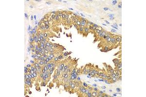 Immunohistochemistry of paraffin-embedded human prostate using DDX58 antibody at dilution of 1:100 (x40 lens). (DDX58 anticorps)