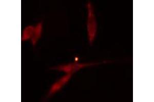 ABIN6274296 staining HeLa cells by IF/ICC.