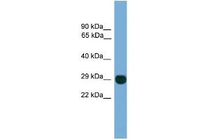WB Suggested Anti-EIF4E2 Antibody Titration: 0. (EIF4E2 anticorps  (N-Term))