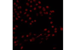 ABIN6266824 staining 293 by IF/ICC. (ZMYND8 anticorps  (Internal Region))