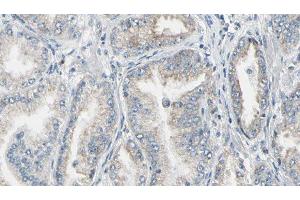 ABIN6276862 at 1/100 staining Human prostate tissue by IHC-P. (FKBP1A anticorps  (N-Term))