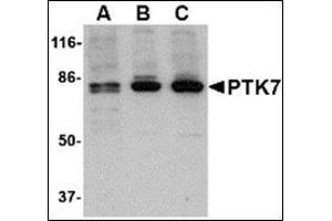 Western blot analysis of PTK7 in (A) human, (B) mouse and (C) rat colon tissue lysate with this product at 1 μg/ml. (PTK7 anticorps  (N-Term))