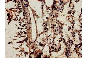Immunocytochemistry analysis of human lung tissue using ABIN7161498 at dilution of 1:100
