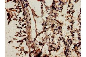 Immunocytochemistry analysis of human lung tissue using ABIN7161498 at dilution of 1:100 (NCF2 anticorps  (AA 178-526))