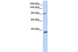 Image no. 1 for anti-Endothelial PAS Domain Protein 1 (EPAS1) (AA 360-409) antibody (ABIN6742258) (EPAS1 anticorps  (AA 360-409))