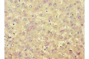Immunohistochemistry of paraffin-embedded human liver tissue using ABIN7142945 at dilution of 1:100