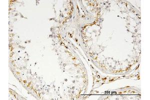 Immunoperoxidase of monoclonal antibody to IL13 on formalin-fixed paraffin-embedded human testis. (IL-13 anticorps)