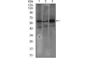 Western blot analysis using FCER1A mouse mAb against SW620 (1), A549 (2), and A431 (3) cell lysate. (Fc epsilon RI/FCER1A anticorps  (AA 42-103))
