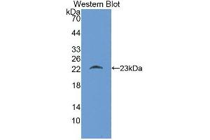 Western blot analysis of the recombinant protein. (KIT anticorps)