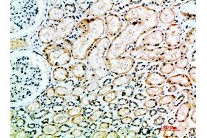 Immunohistochemical analysis of paraffin-embedded human-kidney, antibody was diluted at 1:200