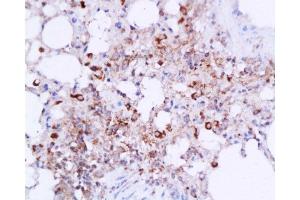 Formalin-fixed and paraffin embedded mouse lung tissue labeled with Anti-IL-6(mo, rat) Polyclonal Antibody, Unconjugated  at 1:200, followed by conjugation to the secondary antibody and DAB staining