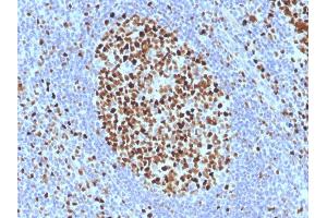 Formalin-fixed, paraffin-embedded human Tonsil stained with MCM7 Monoclonal Antibody (SPM379).