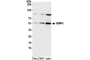Western Blotting (WB) image for anti-WW Domain Binding Protein 4 (WBP4) (AA 125-175) antibody (ABIN7452853)