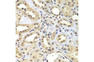 Immunohistochemistry of paraffin-embedded human kidney using SUPT20H antibody (ABIN5975125) at dilution of 1/100 (40x lens). (FAM48A/P38IP anticorps)