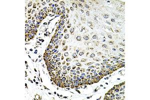 Immunohistochemistry of paraffin-embedded human esophagus using SDC2 antibody (ABIN3022587, ABIN3022588, ABIN3022589 and ABIN6218928) at dilution of 1:100 (40x lens). (Syndecan 2 anticorps  (AA 19-144))
