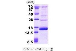 Figure annotation denotes ug of protein loaded and % gel used. (HBG2 Protéine)