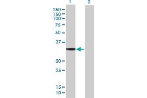 Western Blot analysis of GNAO1 expression in transfected 293T cell line by GNAO1 MaxPab polyclonal antibody. (GNAO1 anticorps  (AA 1-302))