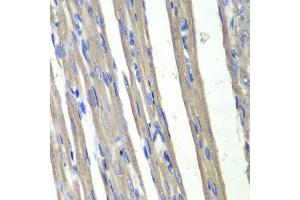 Immunohistochemistry of paraffin-embedded rat heart using C3 antibody (ABIN6131144, ABIN6136723, ABIN6136724 and ABIN6217618) at dilution of 1:100 (40x lens). (AKR1C3 anticorps  (AA 1-323))