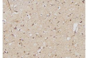 ABIN6268934 at 1/100 staining Human brain tissue by IHC-P.