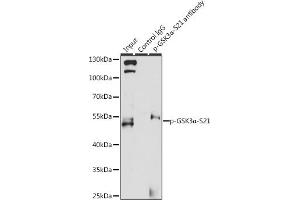 Immunoprecipitation analysis of 200 μg extracts of 293T cells, using 3 μg Phospho-GSK3α-S21 pAb (ABIN6135231, ABIN6136096, ABIN6136097 and ABIN6225606). (GSK3 alpha anticorps  (pSer21))