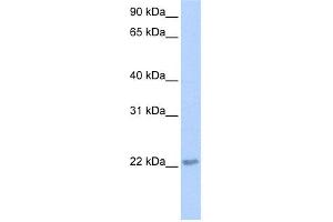 WB Suggested Anti-TCEAL2 Antibody Titration:  0. (TCEAL2 anticorps  (N-Term))