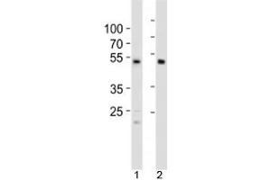 Western blot analysis of lysate from 1) HCT116 cell line and 2) human heart tissue using SOX7 antibody at 1:1000.
