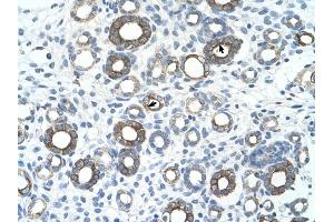 UBE2J1 antibody was used for immunohistochemistry at a concentration of 4-8 ug/ml to stain Epithelial cells of renal tubule (arrows) in Human Kidney.
