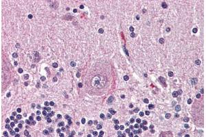 Human Brain, Cerebellum (formalin-fixed, paraffin-embedded) stained with NTSR2 antibody ABIN399994 at 10 ug/ml followed by biotinylated goat anti-rabbit IgG secondary antibody ABIN481713, alkaline phosphatase-streptavidin and chromogen. (NTSR2 anticorps  (Internal Region))
