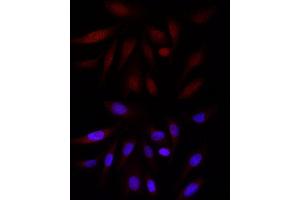 Immunofluorescence analysis of U2OS cells using EP300 Rabbit pAb (ABIN6127823, ABIN6140193, ABIN6140194 and ABIN6216844) at dilution of 1:100 (40x lens).