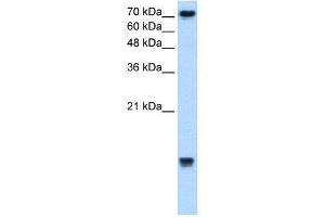 WB Suggested Anti-UBE2N  Antibody Titration: 2. (UBE2N anticorps  (Middle Region))