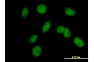 Immunofluorescence of purified MaxPab antibody to FANCM on HeLa cell.