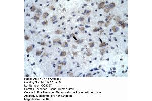 Human Brain (KCNH5 anticorps  (N-Term))