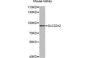 Western blot analysis of extracts of mouse kidney, using SLC22A2 antibody (ABIN6291468) at 1:1000 dilution. (SLC22A2 anticorps)