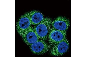 Immunofluorescence (IF) image for anti-Discoidin Domain Receptor tyrosine Kinase 1 (DDR1) antibody (ABIN3003119) (DDR1 anticorps)