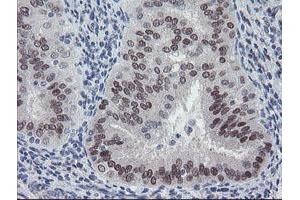 Image no. 3 for anti-Meis Homeobox 3 (MEIS3) (AA 1-261) antibody (ABIN1490670)