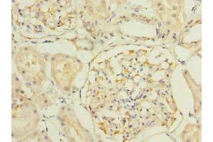 Immunohistochemistry of paraffin-embedded human kidney tissue using ABIN7170183 at dilution of 1:100 (SLC25A33 anticorps  (AA 66-120))