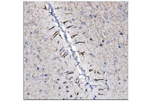 IHC analysis of Alpha Internexin/INA using anti-Alpha Internexin/INA antibody (ABIN7602187). (INA anticorps  (AA 62-169))