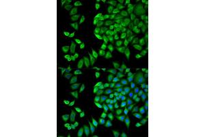 Immunofluorescence (IF) image for anti-WNK Lysine Deficient Protein Kinase 1 (WNK1) antibody (ABIN1875447) (WNK1 anticorps)