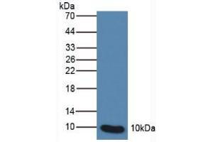 Western blot analysis of Human Leukocyte Cells. (S100P anticorps  (AA 1-95))
