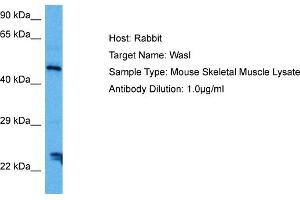 Host: Mouse Target Name: WASL Sample Tissue: Mouse Skeletal Muscle Antibody Dilution: 1ug/ml (Neural Wiskott-Aldrich syndrome protein (WASL) (Middle Region) anticorps)