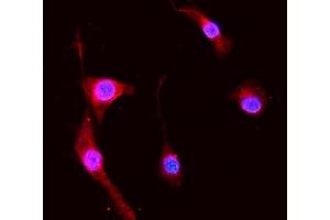 IF analysis of S100A8 using anti-S100A8 antibody (ABIN3042481). (S100A8 anticorps  (AA 2-89))