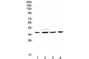 Western blot testing of human 1) HeLa, 2) SGC-7901, 3) K562 and 4) mouse SP2/0 lysate with Cdk6 antibody at 0. (CDK6 anticorps  (AA 1-326))