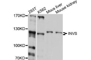Western blot analysis of extract of various cells, using INVS antibody.