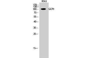 Western Blotting (WB) image for anti-Folate Hydrolase 1B (FOLH1B) (Internal Region) antibody (ABIN3175245) (FOLH1B anticorps  (Internal Region))