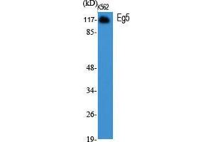 Western Blot (WB) analysis of specific cells using Eg5 Polyclonal Antibody.