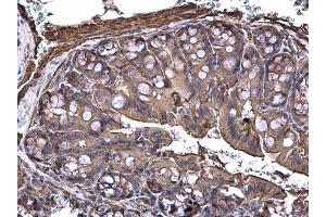 IHC-P Image MAP3K8 antibody [N3C3] detects MAP3K8 protein at cytoplasm on mouse colon by immunohistochemical analysis.
