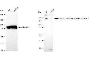 Western blotting analysis using erb-b2 receptor tyrosine kinase 2 antibody (ABIN7800158).